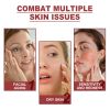OUHOE Collagen Membrane, Lighten Wrinkles, Bags, Dark Circles, Firm Skin, Plump And Moisturize Eye Rejuvenation Mask